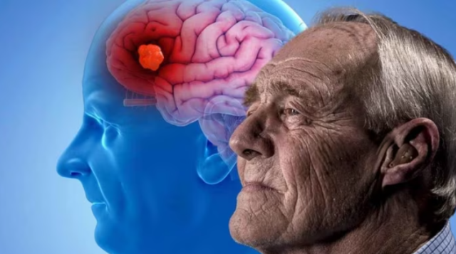 El alzhéimer podría prevenirse a través de los ojos