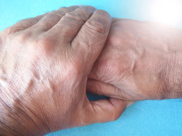 Parkinson