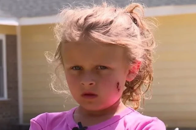 Una niña de seis años fue baleada en la cara por entrar al patio de su vecino a buscar una pelota