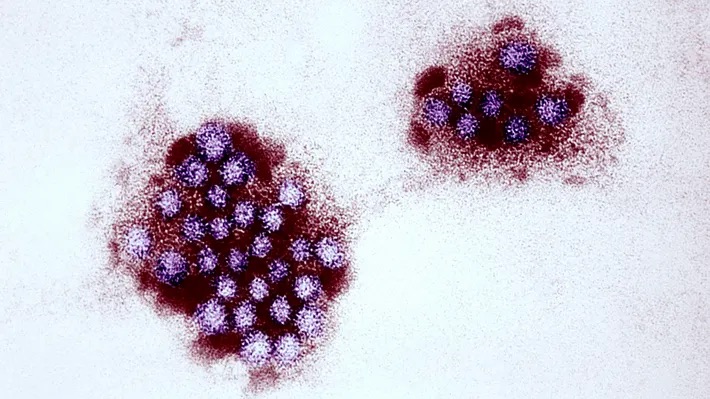 Llegó el norovirus a Estados Unidos