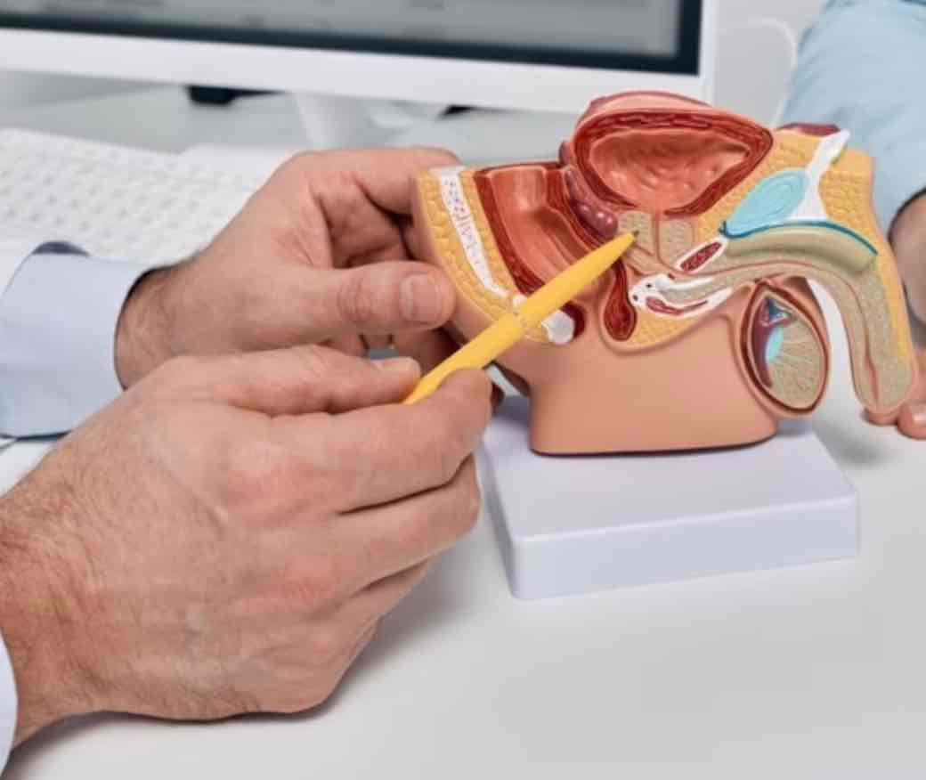 ¿Qué es el Cáncer de Próstata?