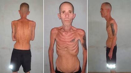 Las impactantes imágenes de un preso político cubano al salir de prisión luego de cinco años tras las rejas
