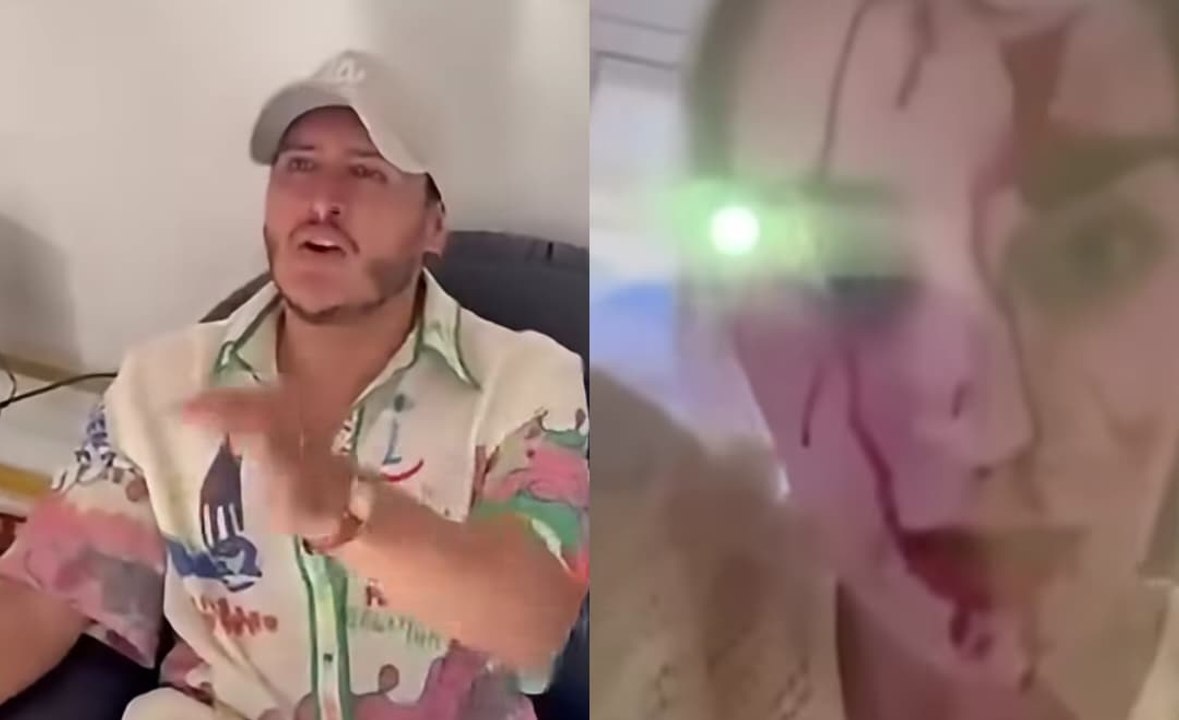 Estilista venezolano agrede brutalmente a Miss Venezuela Global
