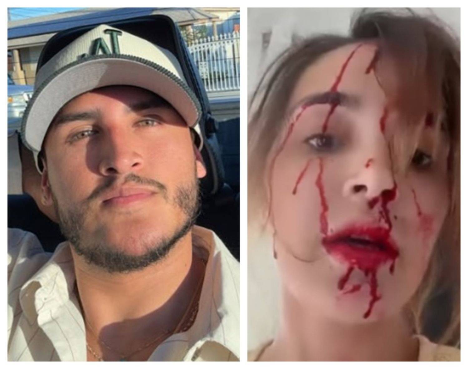 Estilista Giovanni Laguna enfrenta prisión por agresión a modelo venezolana