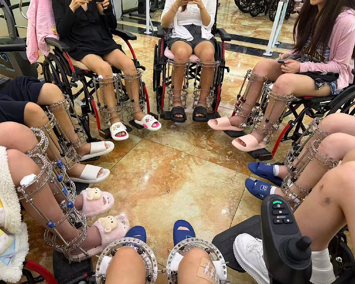 Romperse las piernas para ser más alta: el negocio clandestino que atrapa a miles de jóvenes chinas