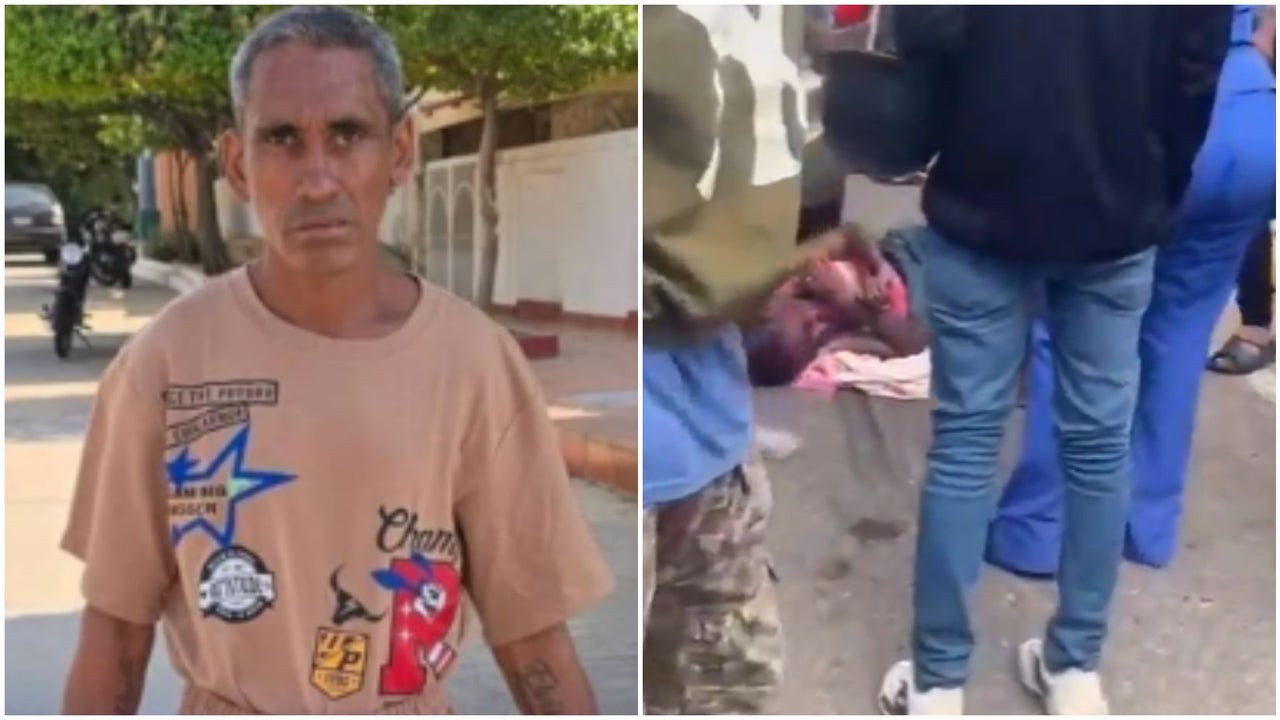 El creador de contenido venezolano 'Elvis Cobra' resultó gravemente herido tras ser arrollado en Zulia | NTN24.COM