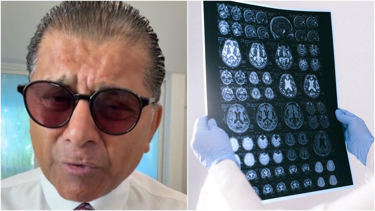 “Me dio eso que llaman ACV”: reconocido actor venezolano Franklin Virgüez habla de su estado de salud | NTN24.COM