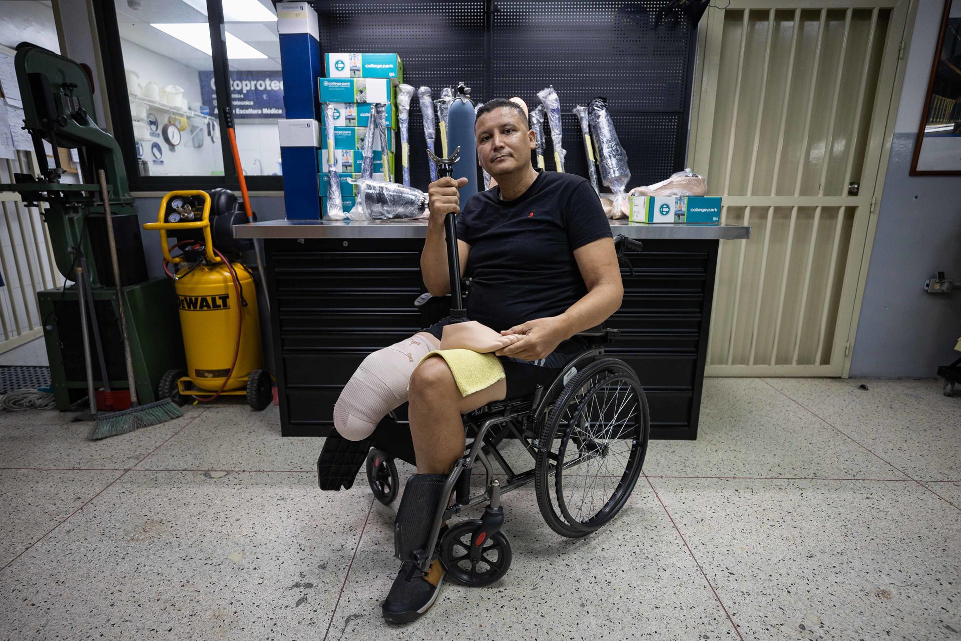 Volver a caminar, la meta de un amputado que dejó el terremoto en Venezuela