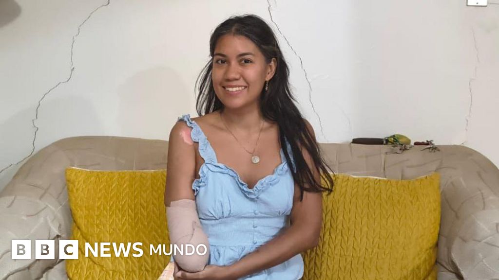 “Perder a mi esposo me duele más que haber perdido mi mano derecha”: el testimonio de Nayarit Colmenares, la mujer amputada tras los terremotos en Venezuela – BBC News Mundo